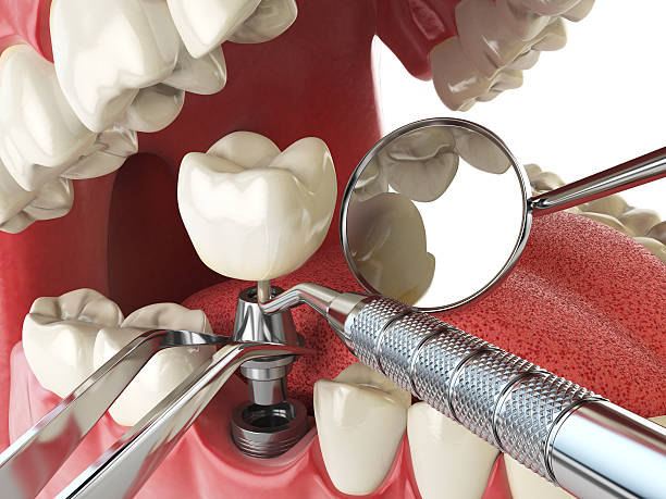 Best Cracked Tooth Emergency Dentist  in Cave City, KY